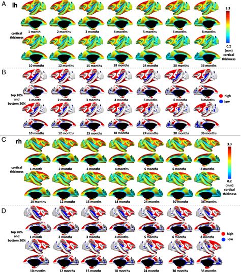 interdatabase variability in cortical thickness measurements|Longitudinal Mapping of Cortical Thickness Measurements: An .